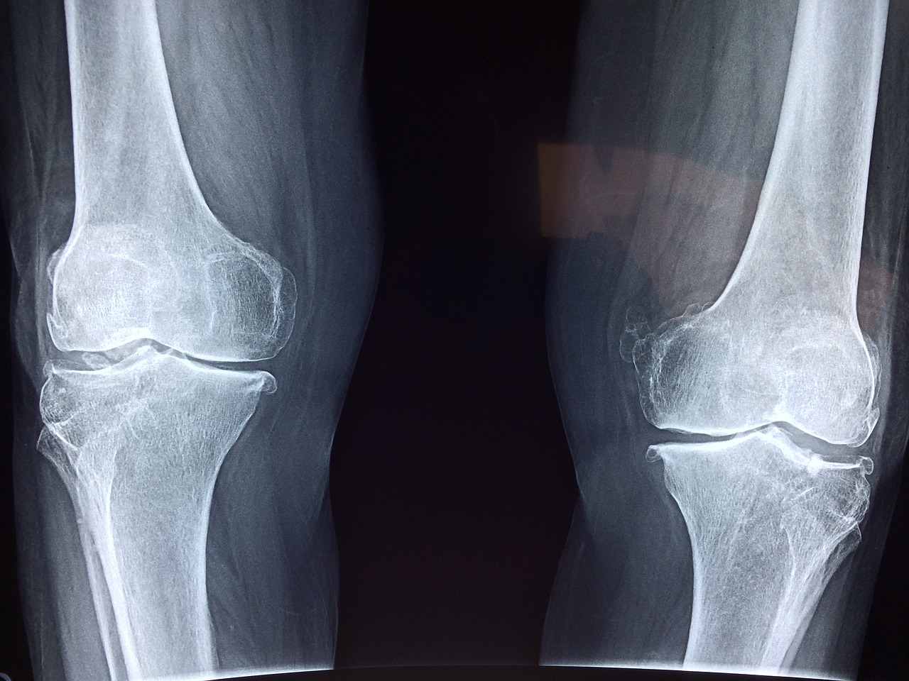 Jaki jest wybór artykułów ortopedycznych?